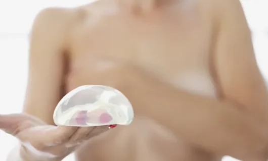 breast-augmentation-02 breast-augmentation-02