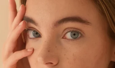 hero-canthoplasty-fox-eye-lift hero-canthoplasty-fox-eye-lift