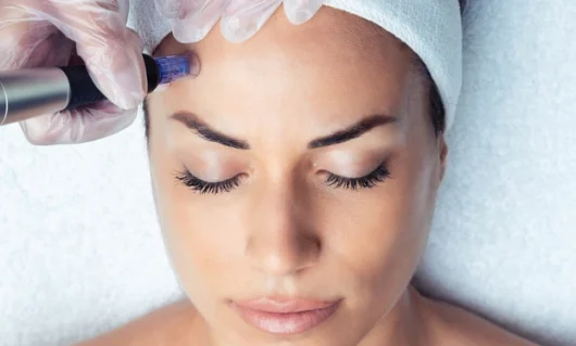 mesotherapy-03 mesotherapy-03