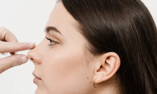 rhinoplasty-02 rhinoplasty-02