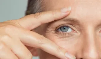 services-eyelid-surgery services-eyelid-surgery