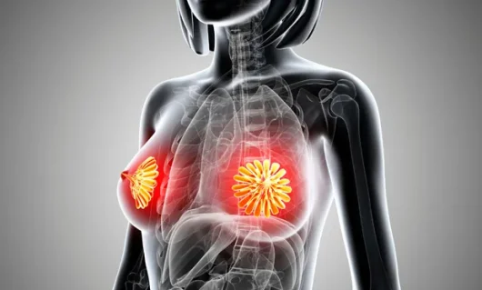 breast-augmentation-03