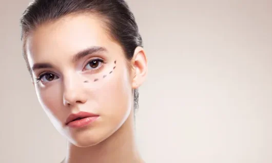 dark-circles-under-eyes-01