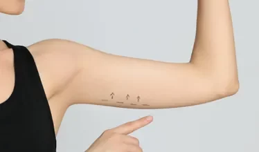 services-arm-and-leg-aesthetics